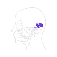 구안와사 마비 환청 저림