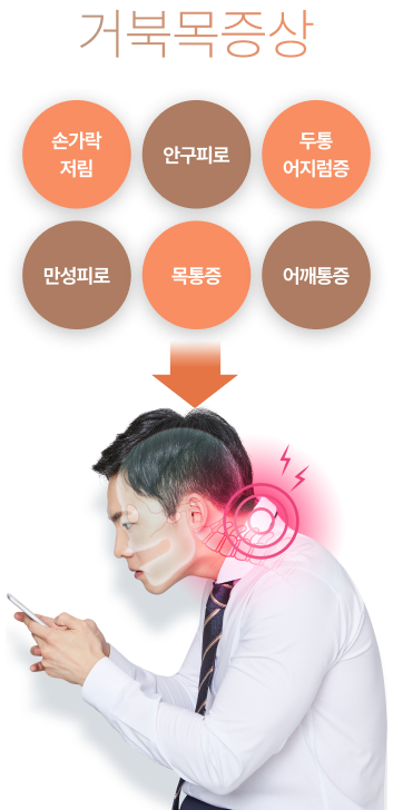 거북목증상 손가락 저림, 안구피로, 두통, 어지럼증, 만성피로, 목통증, 어깨통증