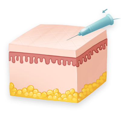  STEP 1통증부위 검사 후 광덕안정 매선실(PDO) 자입